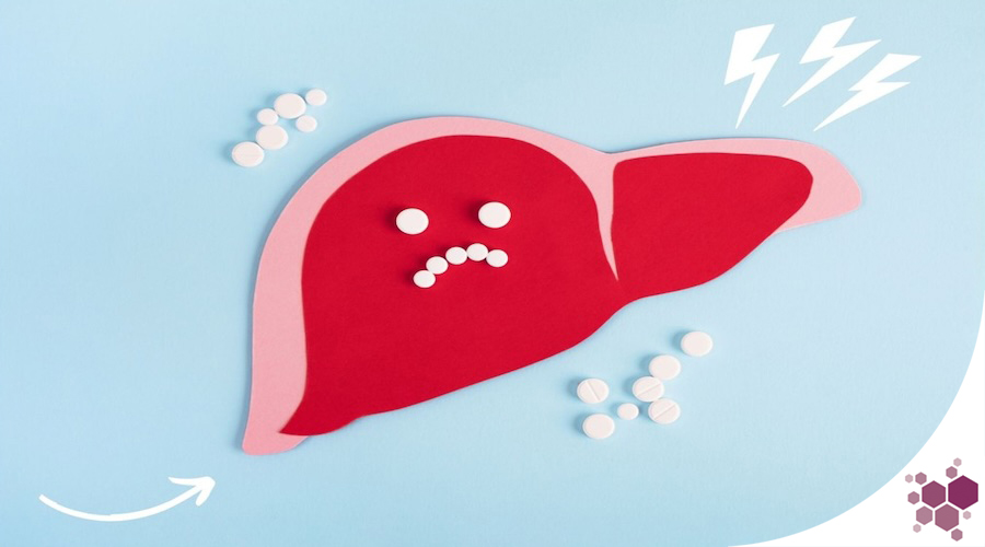 Drug Induced Liver Injury Graphic